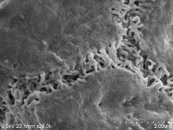 Capillary-bile-duct-conductive-staining2